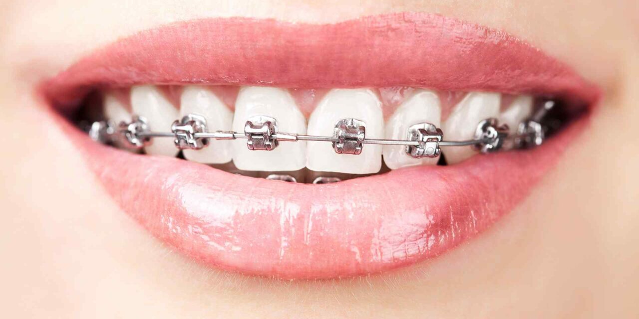 Come fa lo smalto dei denti a durare tutta la vita?