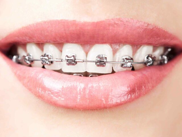 https://www.nova-dental.it/wp-content/uploads/2020/01/post_05-640x480.jpg
